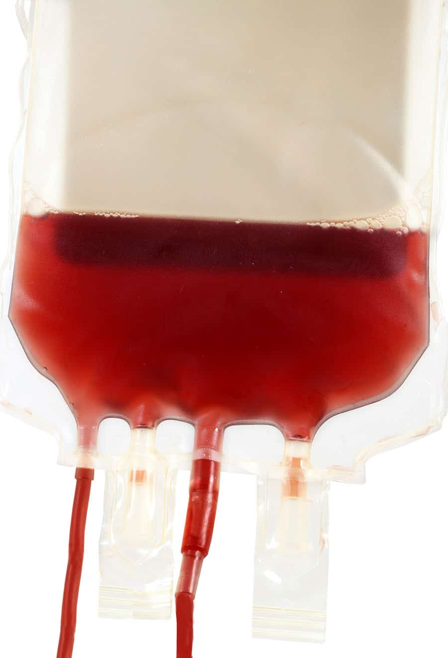 transfusion bloody-donate
