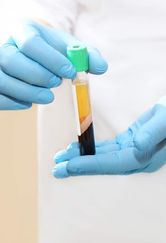 Human Buffy Coat Samples iSpecimen