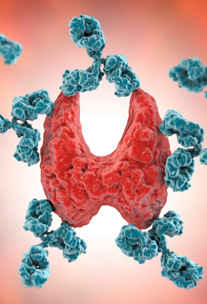 Autoimmune Disease Samples | iSpecimen