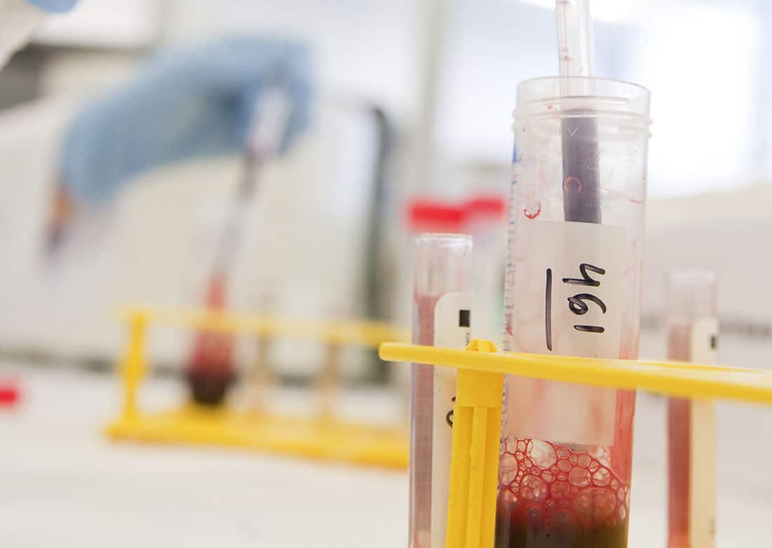 Close-up of a test tube with blood and a hand holding a pipette.