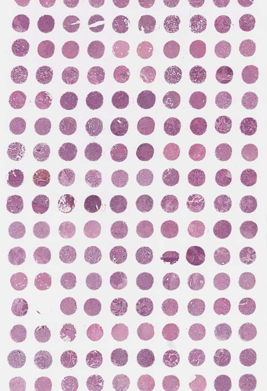 Microarray