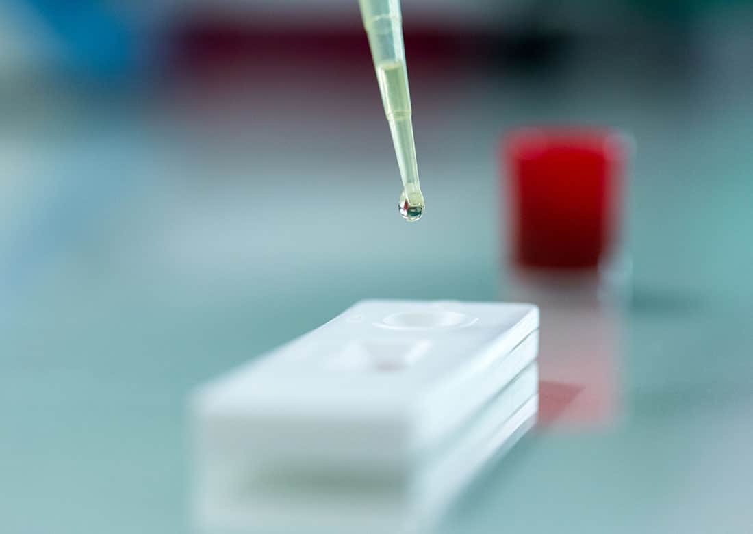 lab technician using automatic pipette dropping specimen to test kit, for testing diagnostic.