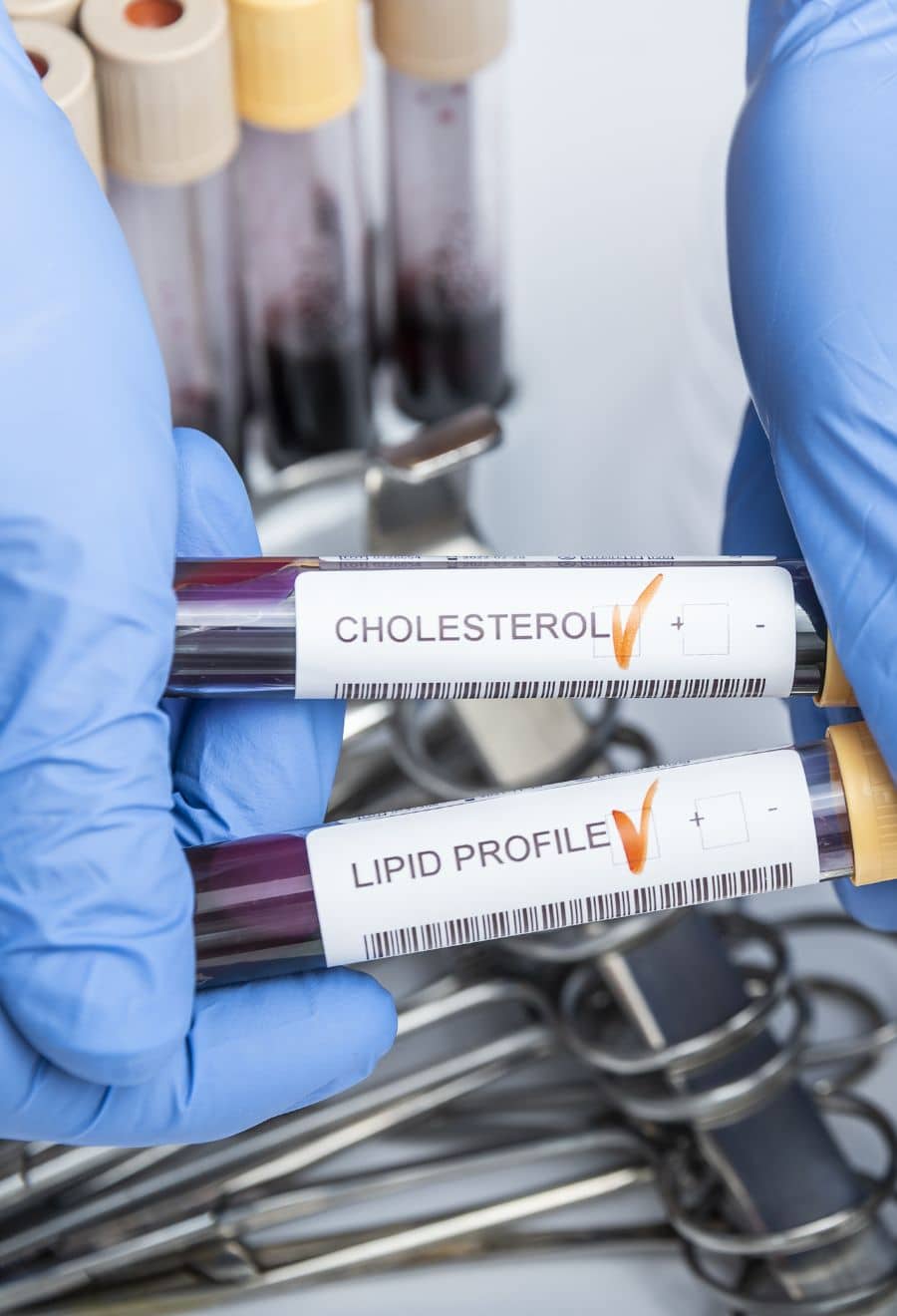 cholesterolbloodvial